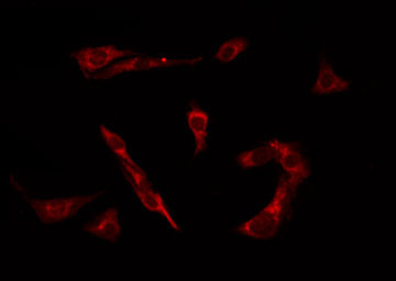 PTEN Antibody - Staining HeLa cells by IF/ICC. The samples were fixed with PFA and permeabilized in 0.1% Triton X-100, then blocked in 10% serum for 45 min at 25°C. The primary antibody was diluted at 1:200 and incubated with the sample for 1 hour at 37°C. An Alexa Fluor 594 conjugated goat anti-rabbit IgG (H+L) Ab, diluted at 1/600, was used as the secondary antibody.