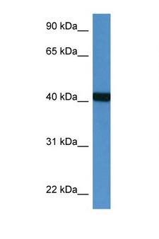 PTER Antibody - PTER antibody Western blot of Fetal Heart lysate. Antibody concentration 1 ug/ml.  This image was taken for the unconjugated form of this product. Other forms have not been tested.