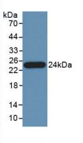 PTF1A Antibody - Western Blot; Sample: Recombinant PTa, Human.