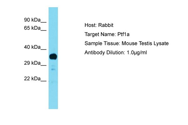 PTF1A Antibody -  This image was taken for the unconjugated form of this product. Other forms have not been tested.