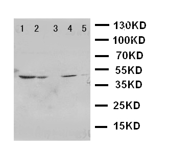 PTGER1 / EP1 Antibody - WB of PTGER1 / EP1 antibody. Lane 1: HELA Cell Lysate. Lane 2: A549 Cell Lysate. Lane 3: MCF-7 Cell Lysate. Lane 4: M231 Cell Lysate. Lane 5: M453 Cell Lysate..