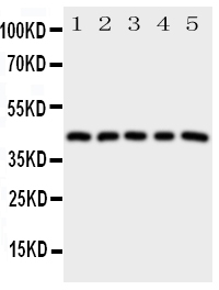 PTGER1 / EP1 Antibody - Anti-Prostaglandin E Receptor EP1 antibody, Western blotting All lanes: Anti Prostaglandin E Receptor EP1 at 0.5ug/ml Lane 1: HELA Whole Cell Lysate at 40ug Lane 2: A549 Whole Cell Lysate at 40ug Lane 3: MCF-7 Whole Cell Lysate at 40ug Lane 4: MM231 Whole Cell Lysate at 40ug Lane 5: MM453 Whole Cell Lysate at 40ug Predicted bind size: 42KD Observed bind size: 42KD