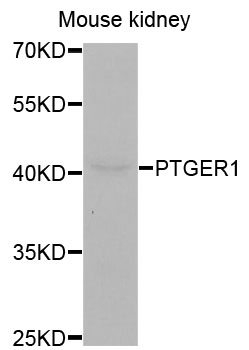 PTGER1 / EP1 Antibody - Western blot analysis of extracts of mouse kidney cells.