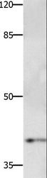 PTGER1 / EP1 Antibody - Western blot analysis of Jurkat cell, using PTGER1 Polyclonal Antibody at dilution of 1:500.