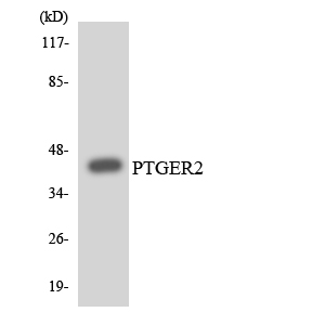 PTGER2 / EP2 Antibody - Western blot analysis of the lysates from HUVECcells using PTGER2 antibody.