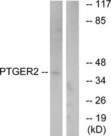 PTGER2 / EP2 Antibody - Western blot analysis of lysates from HeLa cells, using PTGER2 Antibody. The lane on the right is blocked with the synthesized peptide.