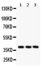 PTGER2 / EP2 Antibody - PTGER2 antibody Western blot. All lanes: Anti PTGER2 at 0.5 ug/ml. Lane 1: Human Placenta Tissue Lysate at 50 ug. Lane 2: A549 Whole Cell Lysate at 40 ug. Lane 3: HEPG2 Whole Cell Lysate at 40 ug. Predicted band size: 40 kD. Observed band size: 40 kD.