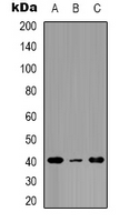 PTGER2 / EP2 Antibody - Western blot analysis of EP2 expression in mouse brain (A); mouse heart (B); rat kidney (C) whole cell lysates.