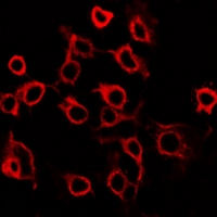 PTGER2 / EP2 Antibody - Immunofluorescent analysis of EP2 staining in HUVEC cells. Formalin-fixed cells were permeabilized with 0.1% Triton X-100 in TBS for 5-10 minutes and blocked with 3% BSA-PBS for 30 minutes at room temperature. Cells were probed with the primary antibody in 3% BSA-PBS and incubated overnight at 4 deg C in a humidified chamber. Cells were washed with PBST and incubated with a DyLight 594-conjugated secondary antibody (red) in PBS at room temperature in the dark. DAPI was used to stain the cell nuclei (blue).