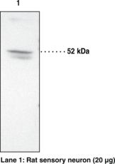 PTGER2 / EP2 Antibody - Western blot of PTGER2 / EP2 antibody.