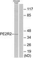 PTGER2 / EP2 Antibody - Western blot analysis of extracts from mouse liver cells, using PE2R2 antibody.