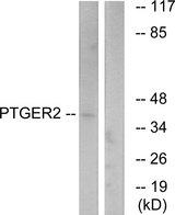 PTGER2 / EP2 Antibody - Western blot analysis of extracts from HeLa cells, using PTGER2 antibody.