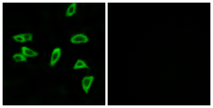 PTGER3 / EP3 Antibody - Immunofluorescence analysis of LOVO cells, using PTGER3 Antibody. The picture on the right is blocked with the synthesized peptide.