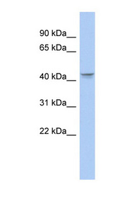 PTGER3 / EP3 Antibody - PTGER3 / EP3 antibody Western blot of Fetal Stomach lysate. This image was taken for the unconjugated form of this product. Other forms have not been tested.