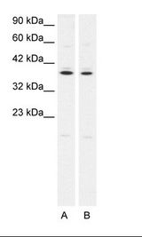 PTGER3 / EP3 Antibody - A. Jurkat Cell Lysate B. HepG2 Cell Lysate.  This image was taken for the unconjugated form of this product. Other forms have not been tested.