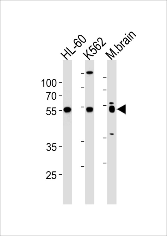 PTGER4 / EP4 Antibody - PTGER4 Antibody western blot of HL-60,K562 cell line and mouse brain lysates (35 ug/lane). The PTGER4 antibody detected the PTGER4 protein (arrow).