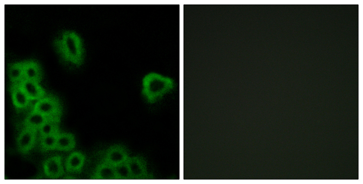 PTGER4 / EP4 Antibody - Immunofluorescence analysis of MCF7 cells, using PE2R4 Antibody. The picture on the right is blocked with the synthesized peptide.