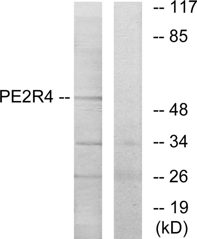 PTGER4 / EP4 Antibody - Western blot analysis of lysates from COLO205 cells, using PE2R4 Antibody. The lane on the right is blocked with the synthesized peptide.
