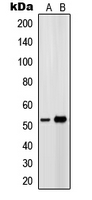 PTGER4 / EP4 Antibody - Western blot analysis of EP4 expression in Ramos (A); HeLa (B) whole cell lysates.