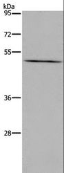 PTGER4 / EP4 Antibody - Western blot analysis of LoVo cell, using PTGER4 Polyclonal Antibody at dilution of 1:600.