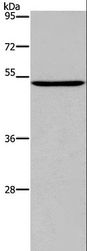 PTGER4 / EP4 Antibody - Western blot analysis of Raji cell, using PTGER4 Polyclonal Antibody at dilution of 1:450.