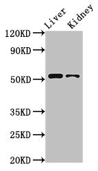 PTGER4 / EP4 Antibody - Positive Western Blot detected in Rat liver tissue, Rat kidney tissue. All lanes: PTGER4 antibody at 3.2 µg/ml Secondary Goat polyclonal to rabbit IgG at 1/50000 dilution. Predicted band size: 54 KDa. Observed band size: 54 KDa