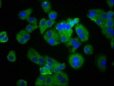 PTGER4 / EP4 Antibody - Immunofluorescence staining of HepG2 cells with PTGER4 Antibody at 1:133, counter-stained with DAPI. The cells were fixed in 4% formaldehyde, permeabilized using 0.2% Triton X-100 and blocked in 10% normal Goat Serum. The cells were then incubated with the antibody overnight at 4°C. The secondary antibody was Alexa Fluor 488-congugated AffiniPure Goat Anti-Rabbit IgG(H+L).