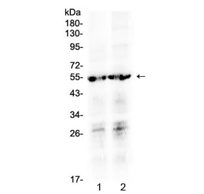 PTGER4 / EP4 Antibody - Western blot testing of human 1) SW620 and 2) MCF7 cell lysate with PTGER4 antibody at 0.5ug/ml. Predicted molecular weight ~53 kDa.