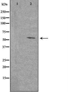 PTGER4 / EP4 Antibody - Western blot analysis of extracts of COLO205 cells using PE2R4 antibody. The lane on the left is treated with the antigen-specific peptide.