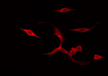 PTGER4 / EP4 Antibody - Staining COLO205 cells by IF/ICC. The samples were fixed with PFA and permeabilized in 0.1% Triton X-100, then blocked in 10% serum for 45 min at 25°C. The primary antibody was diluted at 1:200 and incubated with the sample for 1 hour at 37°C. An Alexa Fluor 594 conjugated goat anti-rabbit IgG (H+L) Ab, diluted at 1/600, was used as the secondary antibody.