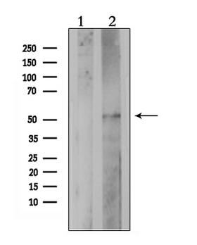PTGER4 / EP4 Antibody - Western blot analysis of extracts of HepG2 cells using PE2R4 antibody. Lane 1 was treated with the antigen-specific peptide.