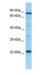 PTGES2 Antibody - PTGES2 antibody Western Blot of Jurkat.  This image was taken for the unconjugated form of this product. Other forms have not been tested.