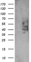 PTGES2 Antibody - HEK293T cells were transfected with the pCMV6-ENTRY control (Left lane) or pCMV6-ENTRY PTGES2 (Right lane) cDNA for 48 hrs and lysed. Equivalent amounts of cell lysates (5 ug per lane) were separated by SDS-PAGE and immunoblotted with anti-PTGES2.