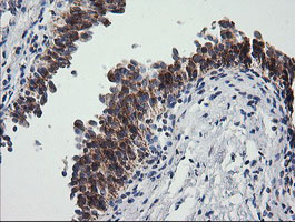 PTGES2 Antibody - IHC of paraffin-embedded Human bladder tissue using anti-PTGES2 mouse monoclonal antibody.