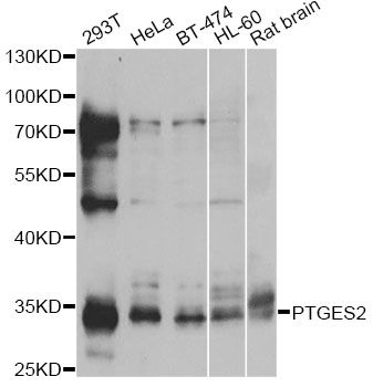 PTGES2 Antibody - Western blot analysis of extracts of various cell lines, using PTGES2 antibody at 1:1000 dilution. The secondary antibody used was an HRP Goat Anti-Rabbit IgG (H+L) at 1:10000 dilution. Lysates were loaded 25ug per lane and 3% nonfat dry milk in TBST was used for blocking. An ECL Kit was used for detection and the exposure time was 5s.