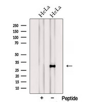 PTGES2 Antibody - Western blot analysis of extracts of HeLa cells using PTGES2 antibody. The lane on the left was treated with blocking peptide.