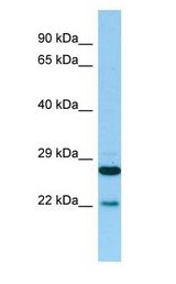 PTGES2 Antibody - PTGES2 antibody Western Blot of 721_B.  This image was taken for the unconjugated form of this product. Other forms have not been tested.