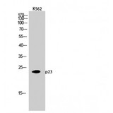 PTGES3 / p23 Antibody - Western blot of p23 antibody