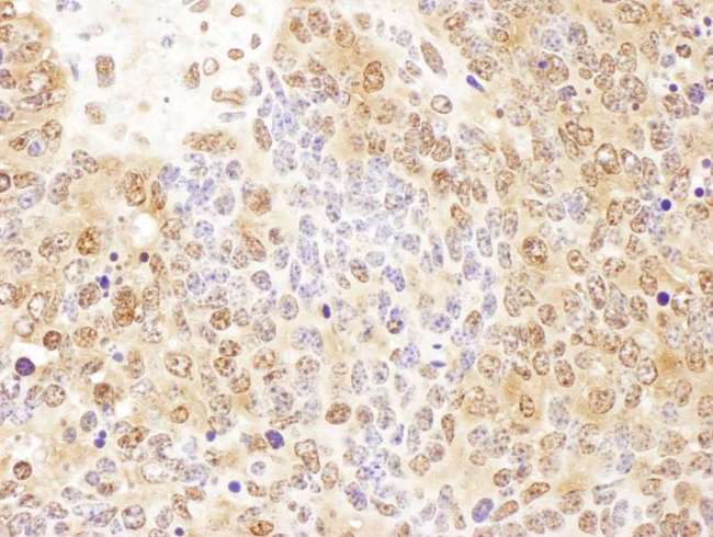 PTGES3 / p23 Antibody - Detection of mouse P23 by immunohistochemistry. Sample: FFPE section of mouse teratoma. Antibody: Affinity purified rabbit anti- P23 used at a dilution of 1:1,000 (1µg/ml). Detection: DAB