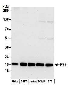 PTGES3 / p23 Antibody - Detection of human and mouse P23 by western blot. Samples: Whole cell lysate (50 µg) from HeLa, HEK293T, Jurkat, mouse TCMK-1, and mouse NIH 3T3 cells prepared using NETN lysis buffer. Antibodies: Affinity purified rabbit anti-P23 antibody used for WB at 0.1 µg/ml. Detection: Chemiluminescence with an exposure time of 30 seconds.