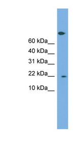 PTGES3 / p23 Antibody - PTGES3 antibody Western blot of COLO205 cell lysate. This image was taken for the unconjugated form of this product. Other forms have not been tested.
