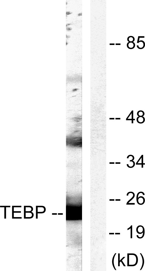 PTGES3 / p23 Antibody - Western blot analysis of lysates from NIH/3T3 cells, treated with EGF 200ng/ml 30', using TEBP Antibody. The lane on the right is blocked with the synthesized peptide.