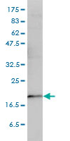 PTGES3 / p23 Antibody - TEBP monoclonal antibody (M01), clone 3H1-2A8 Western blot of TEBP expression in HeLa.