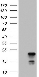 PTGES3 / p23 Antibody - HEK293T cells were transfected with the pCMV6-ENTRY control (Left lane) or pCMV6-ENTRY PTGES3 (Right lane) cDNA for 48 hrs and lysed. Equivalent amounts of cell lysates (5 ug per lane) were separated by SDS-PAGE and immunoblotted with anti-PTGES3.