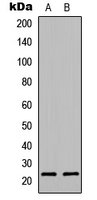 PTGES3 / p23 Antibody - Western blot analysis of p23 expression in Jurkat (A); NIH3T3 (B) whole cell lysates.