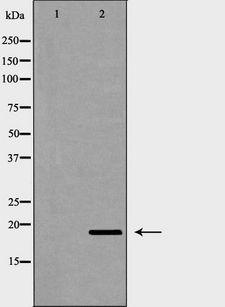 PTGES3 / p23 Antibody - Western blot analysis of HeLa whole cells lysates using PTGES3 antibody. The lane on the left is treated with the antigen-specific peptide.