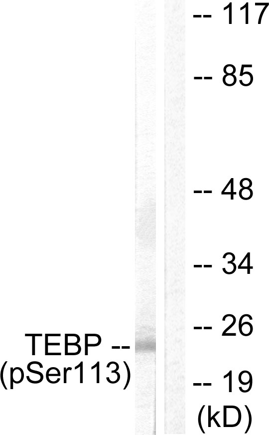 PTGES3 / p23 Antibody - Western blot analysis of lysates from NIH/3T3 cells treated with EGF 200ng/ml 30', using TEBP (Phospho-Ser113) Antibody. The lane on the right is blocked with the phospho peptide.