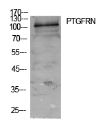 PTGFRN Antibody - Western Blot analysis of extracts from 293 cells using PTGFRN Antibody.