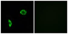 PTGIR / IP Receptor Antibody - Immunofluorescence analysis of LOVO cells, using Prostacyclin Receptor Antibody. The picture on the right is blocked with the synthesized peptide.
