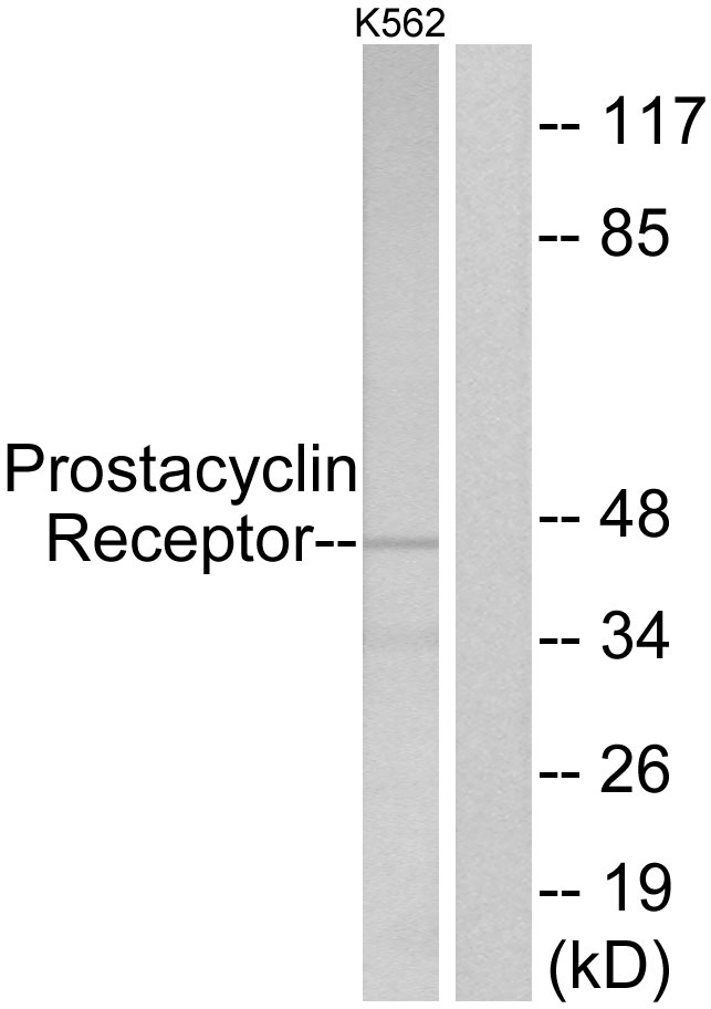 PTGIR / IP Receptor Antibody - Western blot analysis of lysates from K562 cells, using Prostacyclin Receptor Antibody. The lane on the right is blocked with the synthesized peptide.